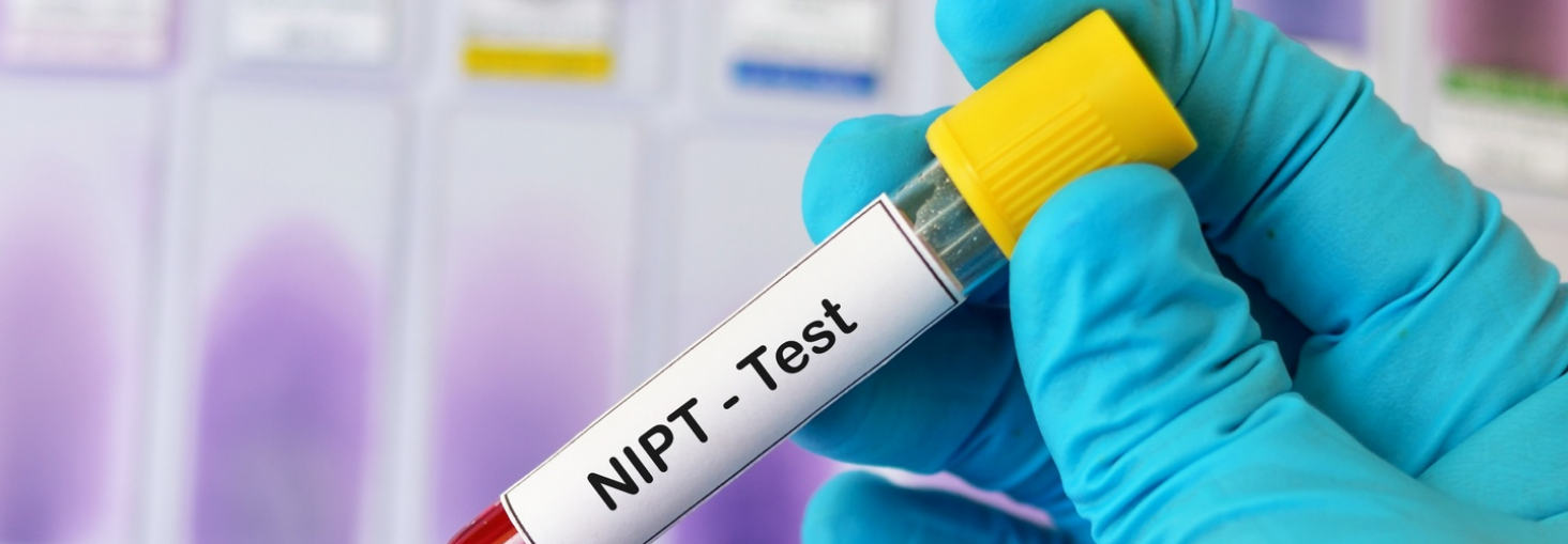 NIPT: TEST DI SCREENING PRENATALE